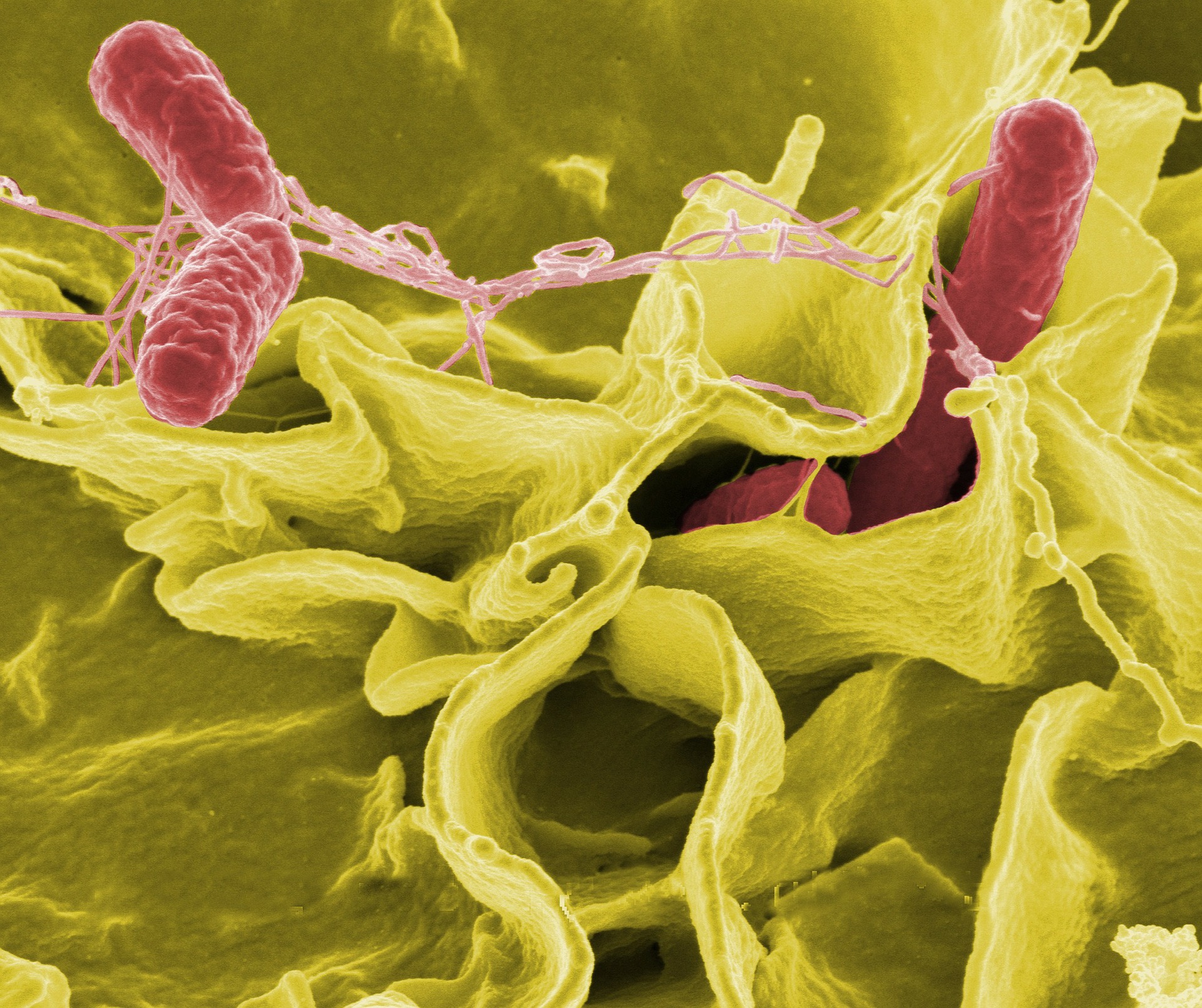 Batteri patogeni e intestino